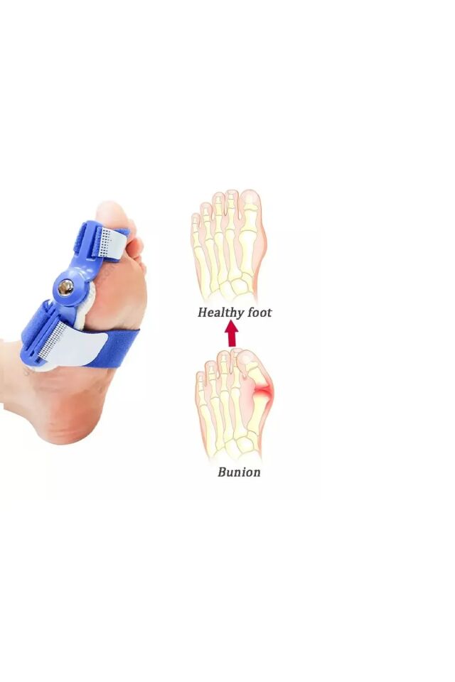 Mucit Home  Atel Ayak Parmak Başparmak Düzeltici Kemik Çıkığı Düzleştirici Taraklı Ayaklar Için Aparat 2'li