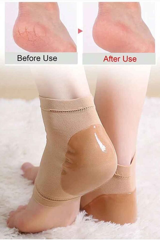 Mucit Home 1 Çift Silikon Nemlendirici Topuk Çorabı Çatlak Nasır İçin Nemlendirici Çorap