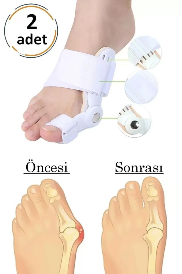 Mucit Home  Atel Ayak Parmak Başparmak Düzeltici Kemik Çıkığı Düzleştirici Taraklı Ayaklar Için Aparat 2'li